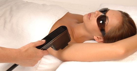 ALEXANDRİTE LAZER EPİLASYON