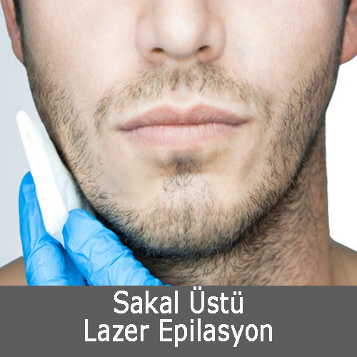 Sakal Üstü Lazer Epilasyon